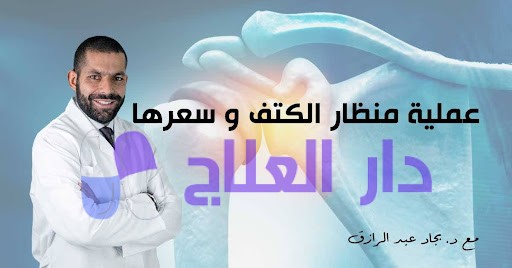 عملية منظار الكتف وسعرها