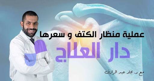 عملية منظار الكتف وسعرها