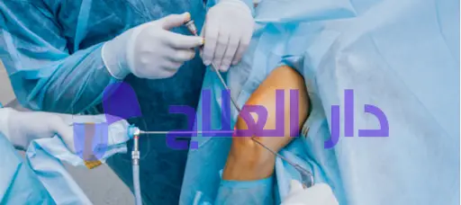 عملية قطع غضروف الركبة بالمنظار​