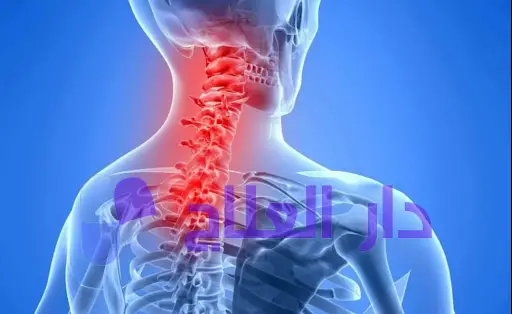 كم تستغرق عملية غضروف الرقبة؟