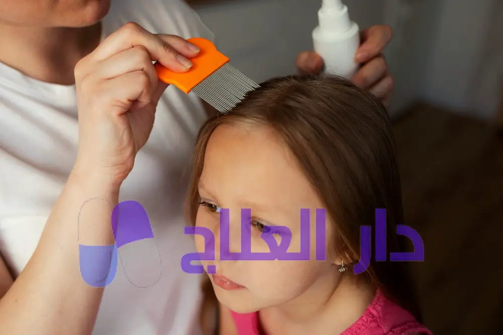 هل القمل يعود رغم العلاج؟